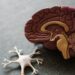 How Diet Impacts Brain Health