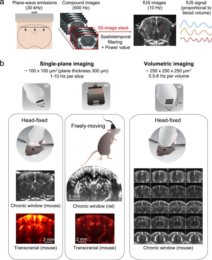 Functional ultrasound imaging provides real-time feedback during spinal surgery