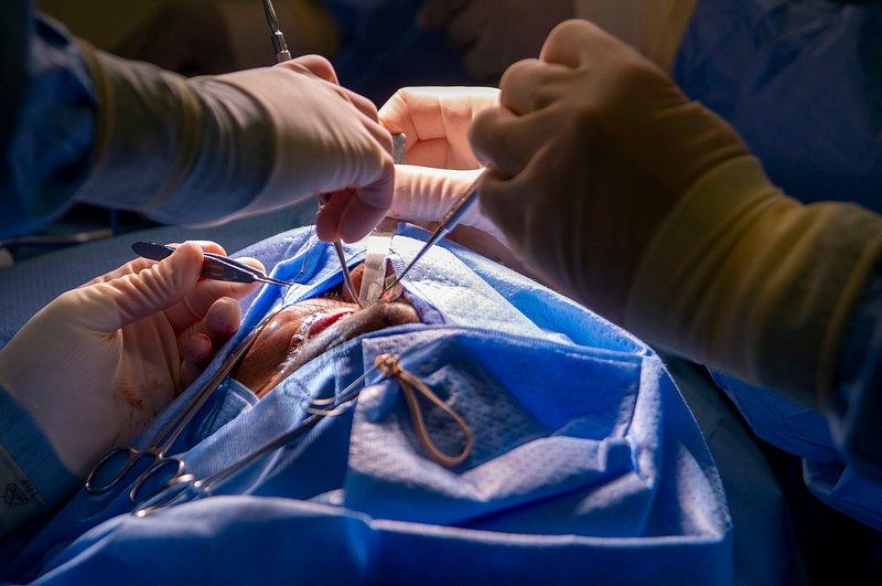 Exploring the Potential Benefits of Surgery